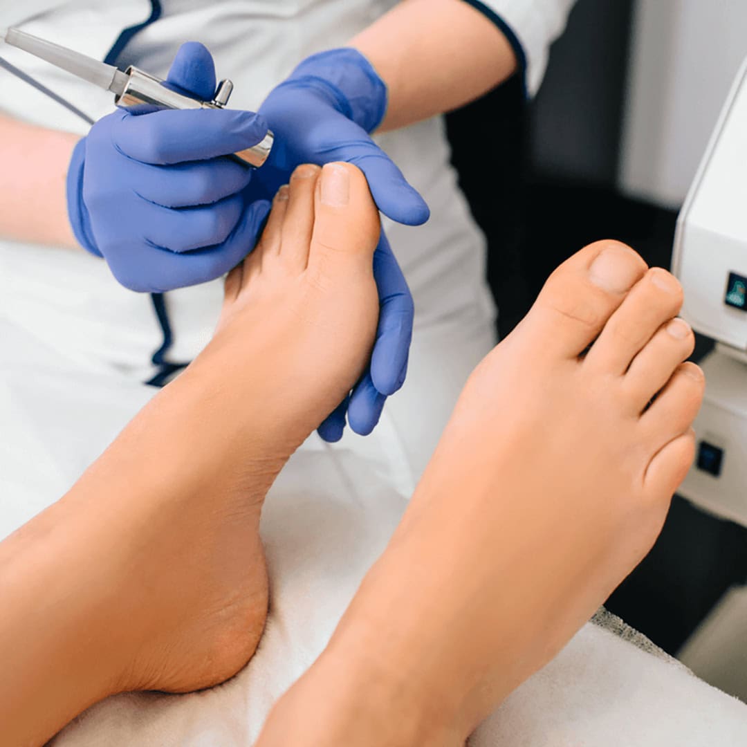 FootPlus-Clinic-Laser-Therapy-Foot